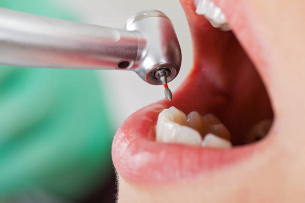 Best Weekend Emergency Dentist in Milford, DE